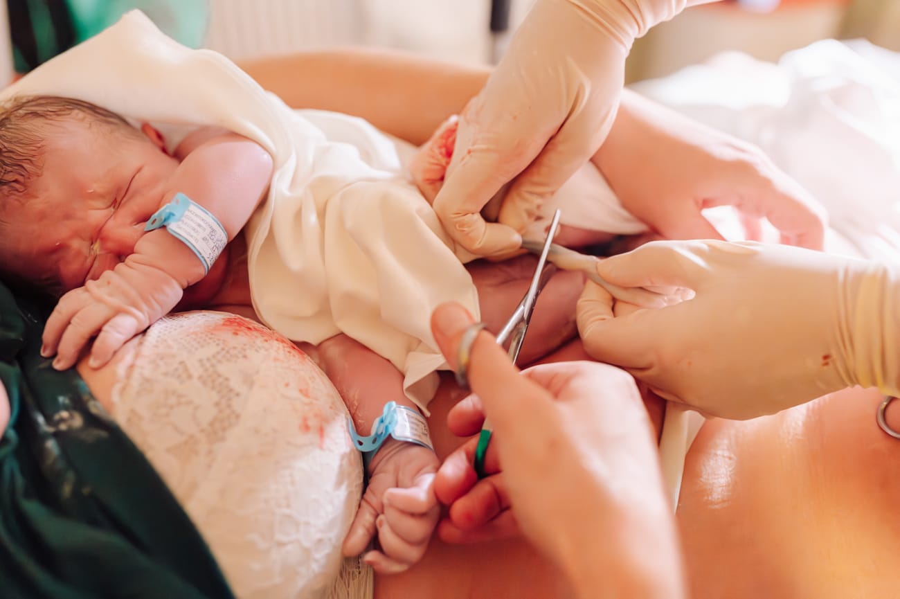 Przecinanie pępowiny Trójmiasto Gdańsk Gdynia Sopot