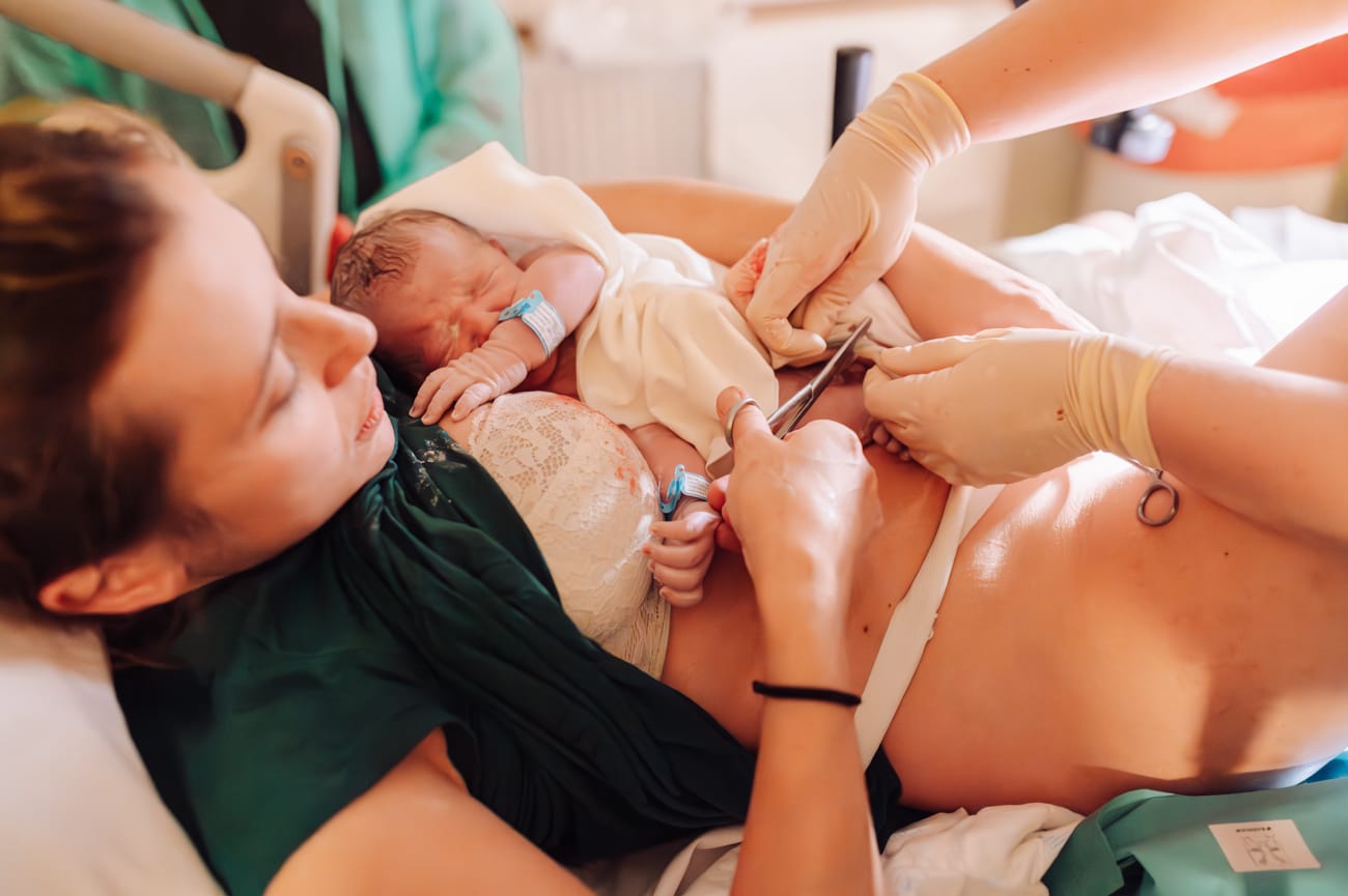 Przecięcie pępowiny po narodzinach Wejherowo