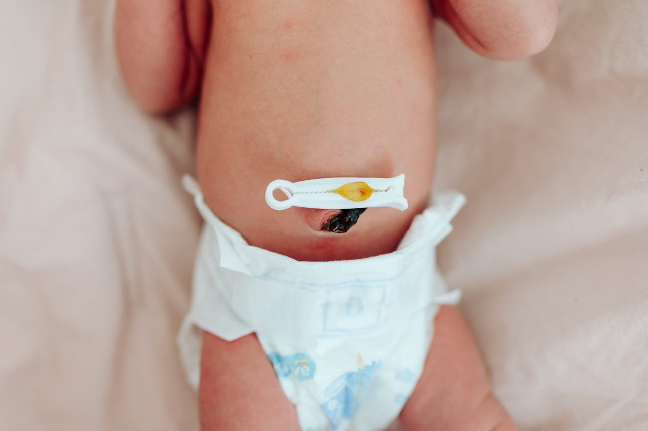 Pępek noworodka z kikutem pępowinowym sesja fresh48 Gdańsk