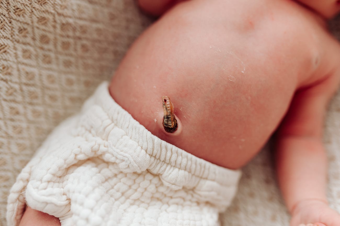 Kikut pępowinowy noworodka detal sesja Gdynia